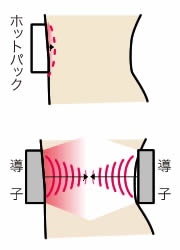 深部発熱で温め癒す超短波治療