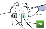 伊藤超短波（株）家庭用総合電流刺激装置 ITO-3D Pro  治療６