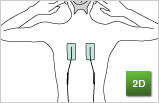 伊藤超短波（株）家庭用総合電流刺激装置 ITO-3D Pro  トレーニング３