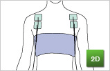 伊藤超短波（株）家庭用総合電流刺激装置 ITO-3D Pro  トレーニング６