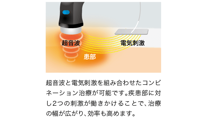 伊藤超短波（株）「イトー ESTIMUS」概要2