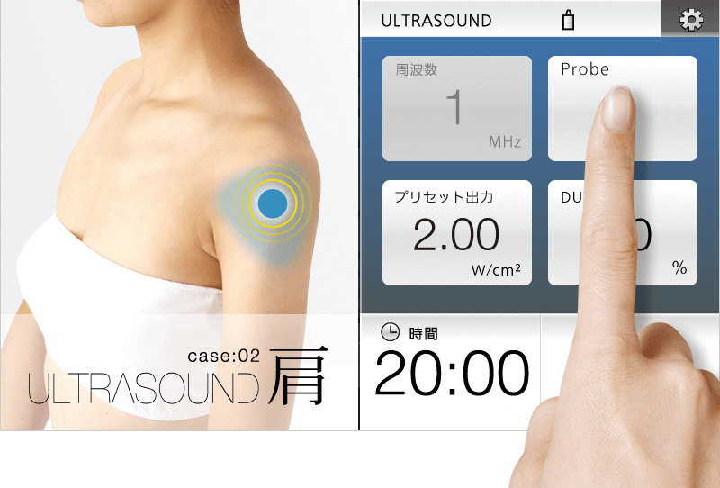 イトー US-711 / イトー US-731　図２