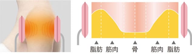 イトー SW-203　図７